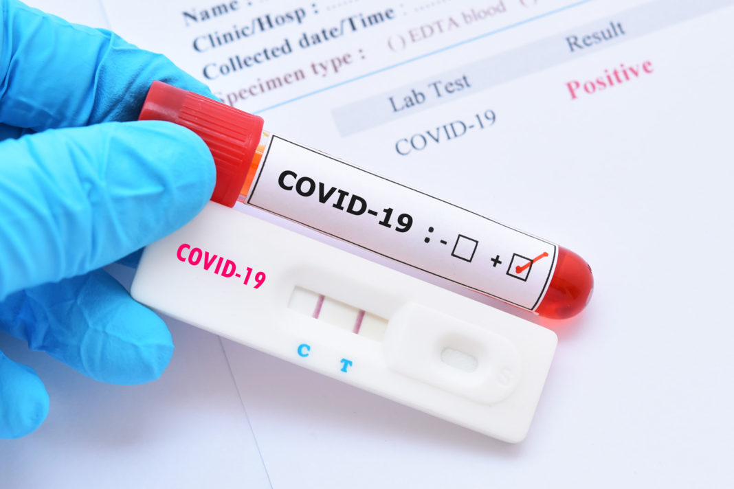 În Europa a fost aprobat testul care arată în 15 minute dacă o persoană are COVID-19