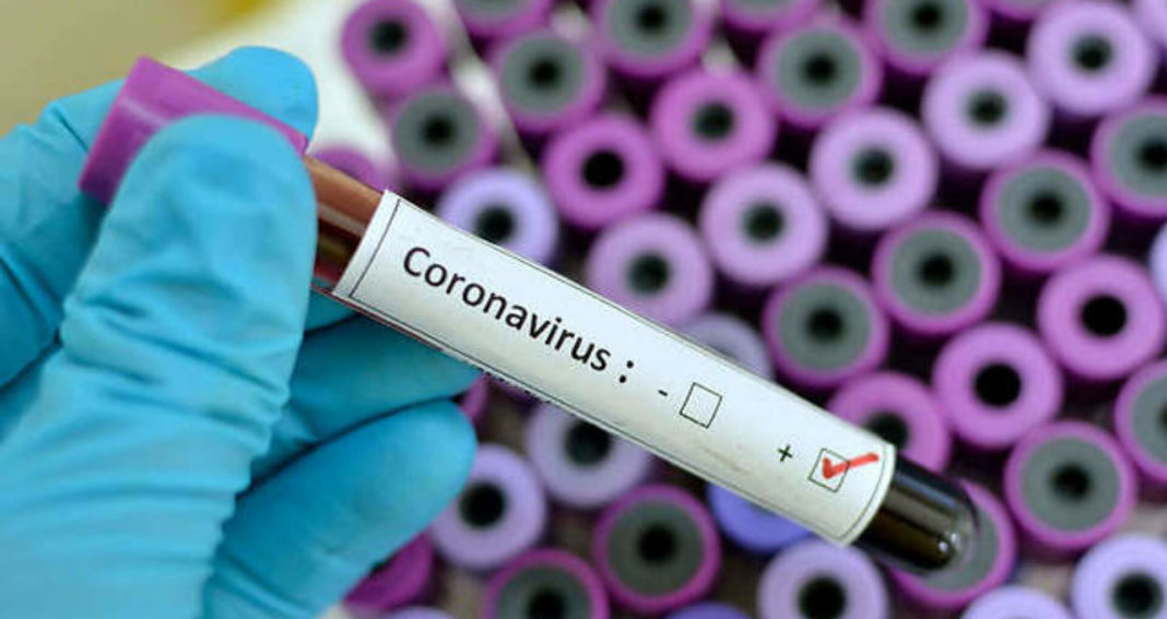 Au fost înregistrate 70 cazuri noi de persoane infectate cu COVID-19, acestea fiind cazuri care nu au mai avut anterior un test pozitiv